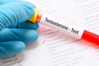 Анализ крови на Тестостерон