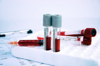 Анализ на Группа крови + Резус-фактор (Rh)