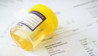 Альфа-амилаза панкреатическая – сдать анализ крови, цены в Москве в «СМ-Клиника»