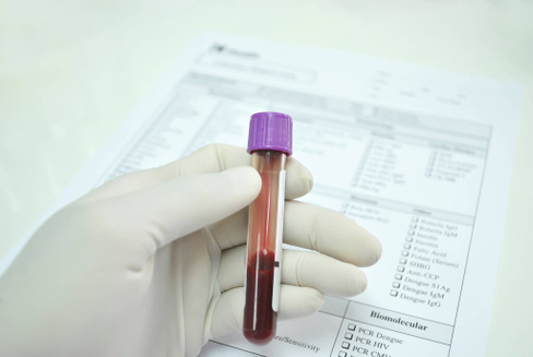 Анализ крови на Антиспермальные антитела