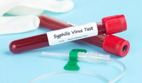 Исследование крови из вены на сифилис методом ИФА (каждый показатель)